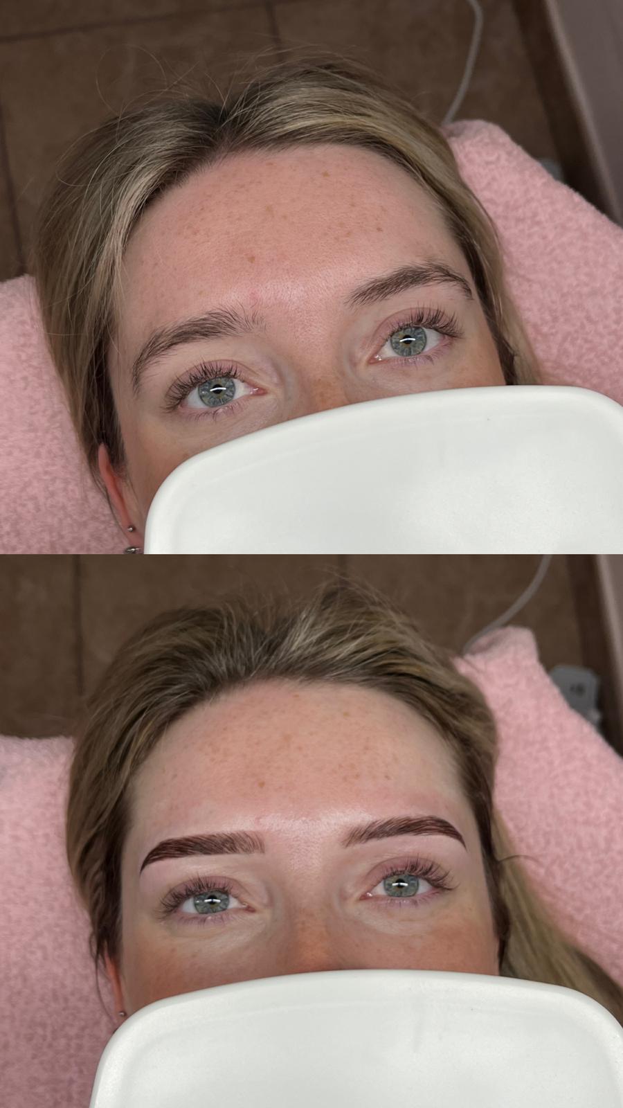 Forfait browlift