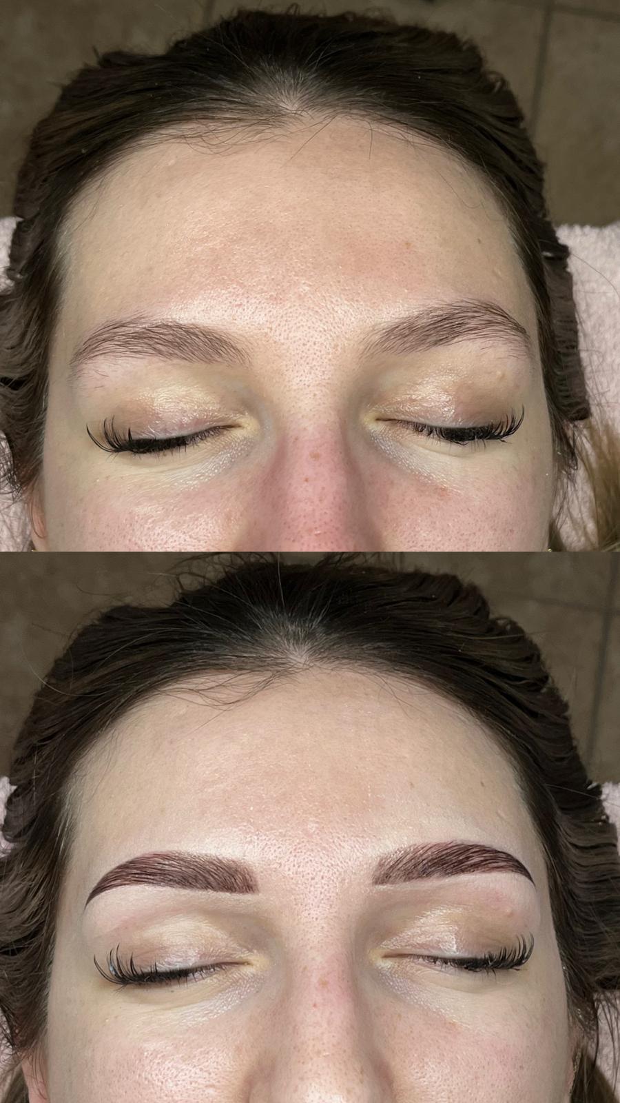Forfait browlift